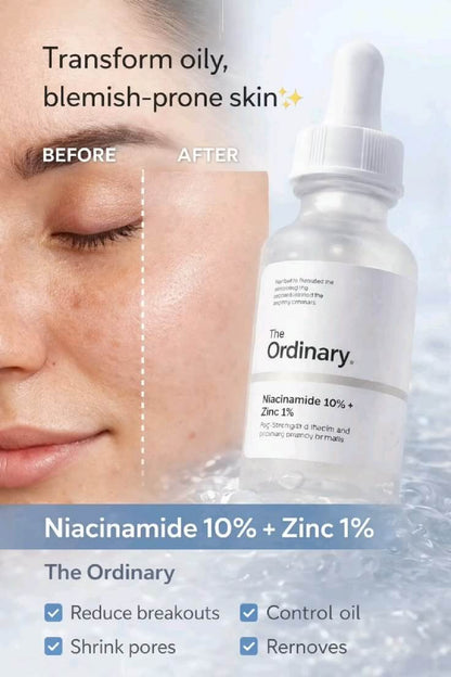 The Ordinary - Niacinamide 10% + Zinc 1%